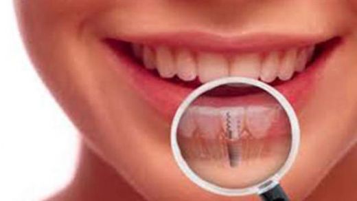 Diş Sinirleri